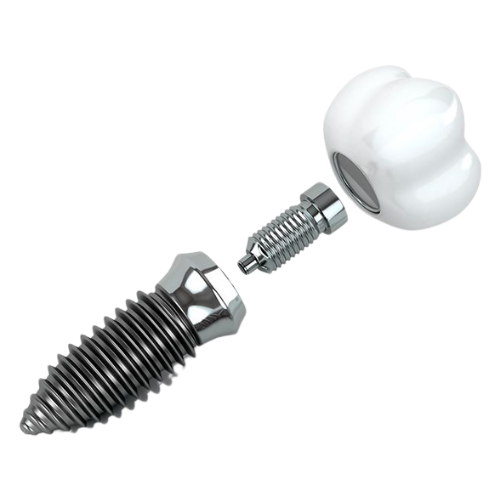 Impianti Dentali